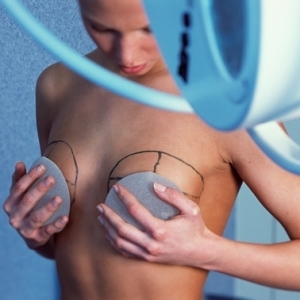 Увеличение груди и абдоминопластика - наиболее востребованные пластические операции