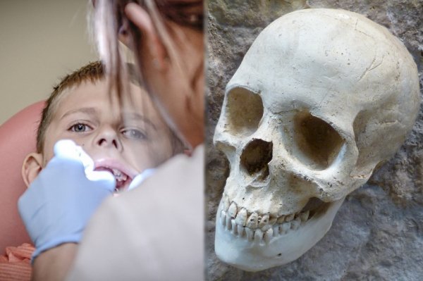 Заговор стоматологов? Зубы пещерных людей без зубной пасты выглядели лучше