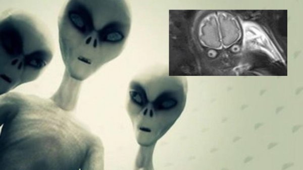 «Отложили» пришельца в россиянку! УЗИ показало жуткое инопланетное существо в чреве жительницы Норильска