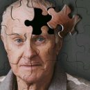 Антитела помогут в диагностике болезни Альцгеймера